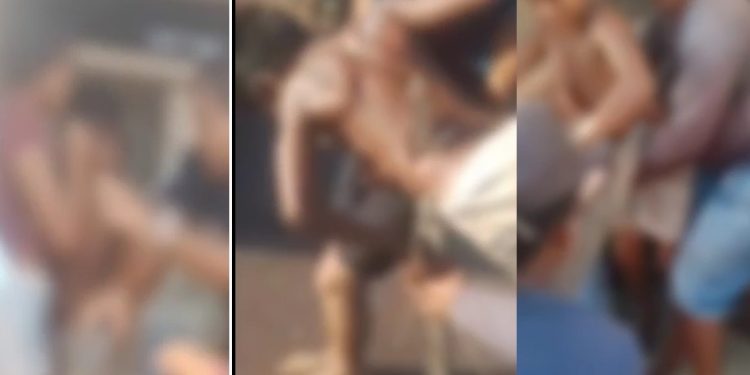 Vídeo forte: menino vai pular cerca para pegar papagaio e fica com madeira cravada no corpo