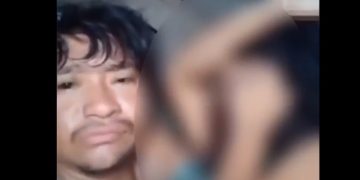 Vídeo forte: marido deixa esposa desfigurada e obriga ela a gravar vídeo: ‘tô nem aí’