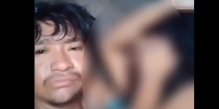 Vídeo forte: marido deixa esposa desfigurada e obriga ela a gravar vídeo: ‘tô nem aí’
