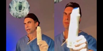 Vídeo: médico retira desodorante do reto de paciente e alerta: ‘risco de m0rte’