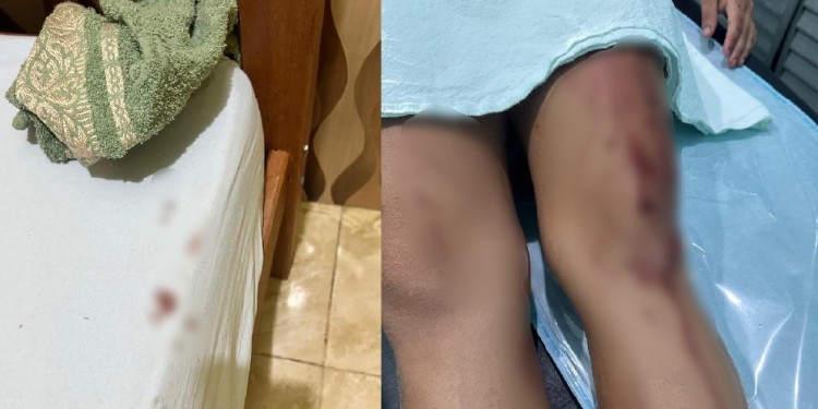 Veja: Mulher que teve o filho m0rt0 pelo ex-companheiro foi hospitalizada após agr3ss0es; veja