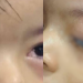 Menino usa cola industrial da mãe artesã e fica com os olhos colados em Parintins