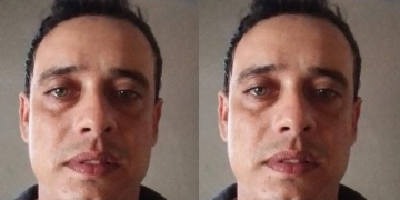 Homem tenta m@tar a companheira e diz no hospital em Manaus que ela caiu da rede