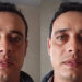 Homem tenta m@tar a companheira e diz no hospital em Manaus que ela caiu da rede