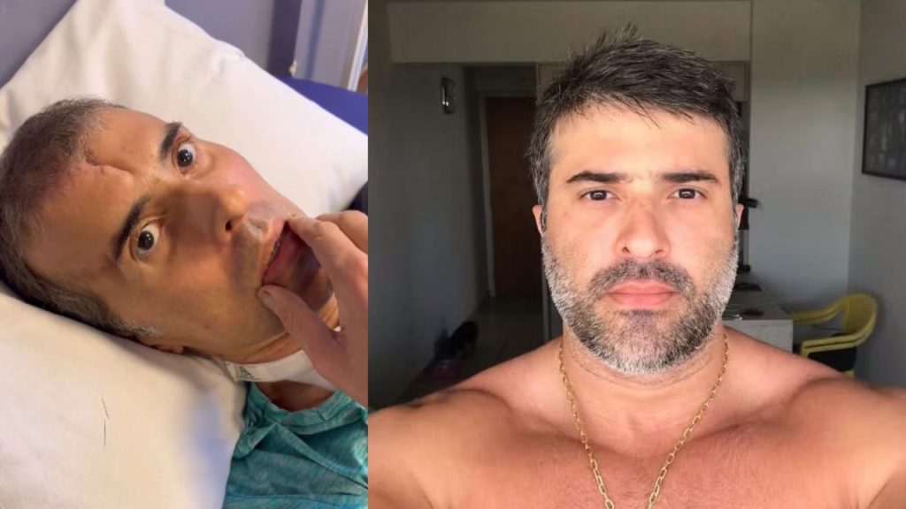 Após meses em c0ma, piloto b4lead0 da Polícia Civil volta a falar; veja o vídeo