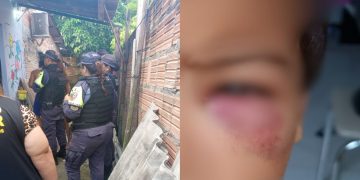 No Manoa, garotinho de 5 anos é esp4nc4d0 dentro de casa e padrasto vai parar na Depca