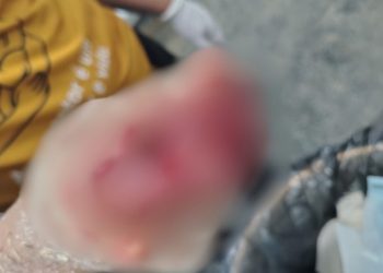 Em Tefé, mulher atinge a mão em lâmina de triturador enquanto cevava mandioca; veja