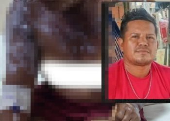 Vídeo: imagem mostra mulher com corp0 queimad0 com gasolina pelo ex no Amazonas