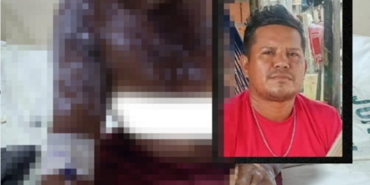 Vídeo: imagem mostra mulher com corp0 queimad0 com gasolina pelo ex no Amazonas