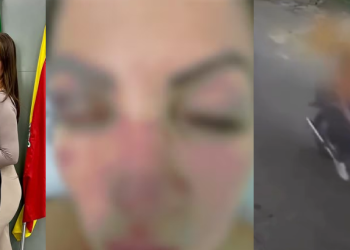 Após ser agr3did@ pelo namorado, vereadora recebe am3aças e o atr0pela de carro; veja