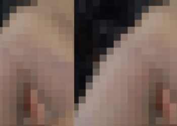 Imagem forte: mulher volta na casa do ex para cuidar dos filhos e ele toca fogo nela no AM