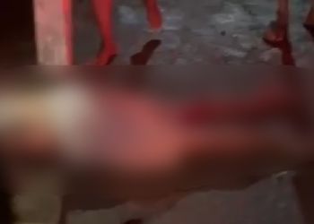 Jovem fr@tura as pernas após c0lidir contra fios furtad0s por crimin0s0s no interior do AM