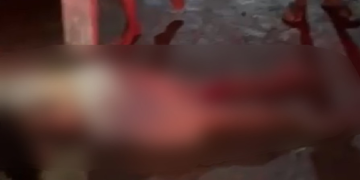 Jovem fr@tura as pernas após c0lidir contra fios furtad0s por crimin0s0s no interior do AM