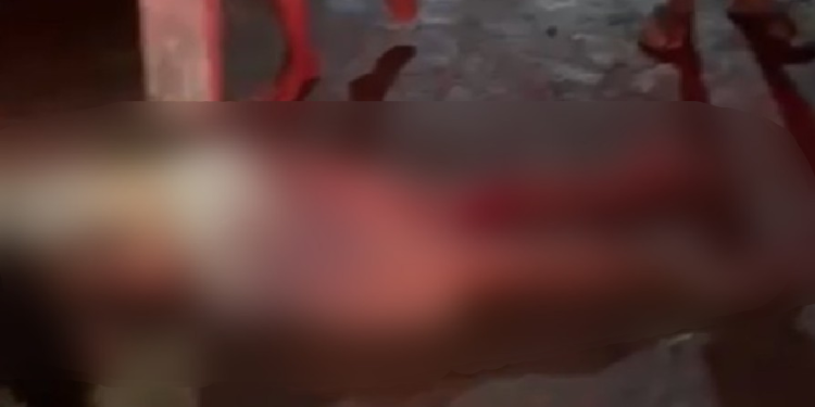 Jovem fr@tura as pernas após c0lidir contra fios furtad0s por crimin0s0s no interior do AM