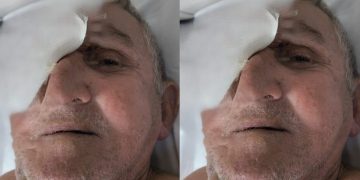 Idoso internado em Manaus após queda não sabe onde mora e não lembra quem são os parentes 