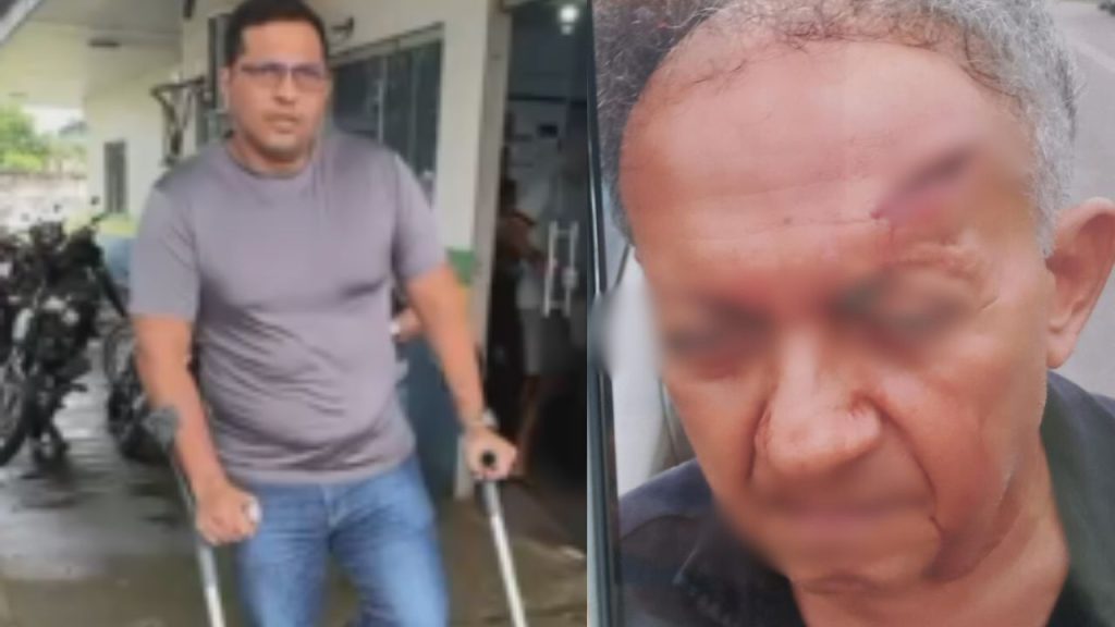 Discussão por Pix termina com idoso f3rid0 na cabeça após golpe de muleta em Itacoatiara
