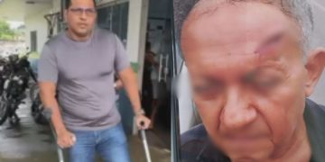 Discussão por Pix termina com idoso f3rid0 na cabeça após golpe de muleta em Itacoatiara