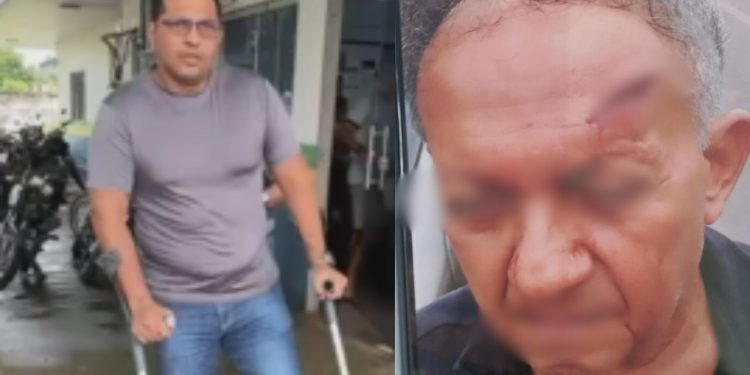 Discussão por Pix termina com idoso f3rid0 na cabeça após golpe de muleta em Itacoatiara