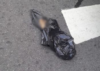 Disputa por passageiros termina com braço de homem amput4d0 após c0lisão com ônibus na São José