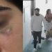 Advogado e cabeleireiro são acusados por jovem de invasão e agr3ssã0 contra ela e a namorada em Manaus