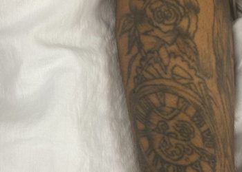 Homem internado após sofrer agressão física busca por familiares no Hospital João Lúcio