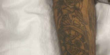 Homem internado após sofrer agressão física busca por familiares no Hospital João Lúcio