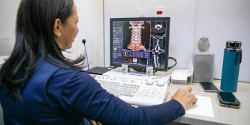 Carreta de Tomografia da UEA leva atendimentos gratuitos para comunidade acadêmica e público externo