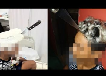 Vídeo: mãe encontra filho ferid0 pelo irmão e pede a médico que tire faca da cabeça dele
