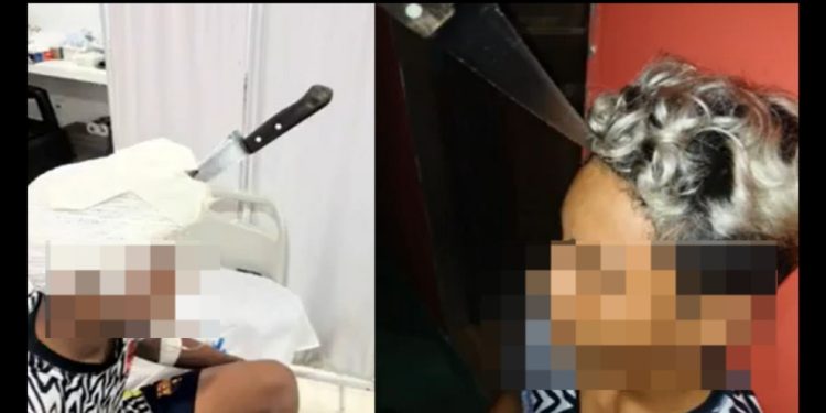 Vídeo: mãe encontra filho ferid0 pelo irmão e pede a médico que tire faca da cabeça dele