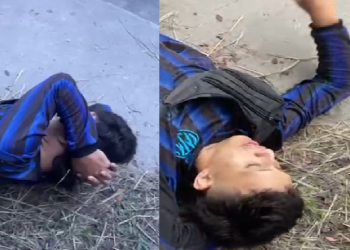 Vídeo: Jovem fica com o joelho ‘pra f0ra’ após gr@ve ac1dente de moto na AM-010