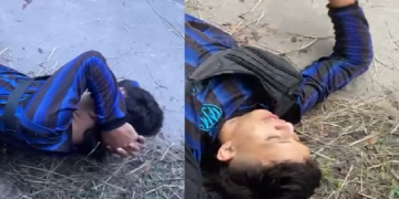 Vídeo: Jovem fica com o joelho ‘pra f0ra’ após gr@ve ac1dente de moto na AM-010