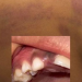 Menino perde o dente após ser agr3did0 pela própria mãe no AM, diz Conselho Tutelar