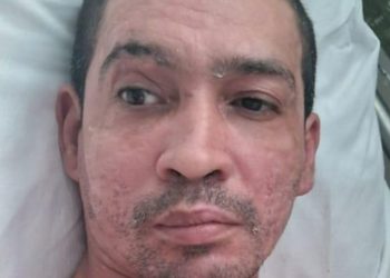 Saiba quem é o paciente que está há 10 meses na Fundação de Medicina Tropical sem receber visitas