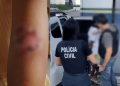 Homem é pr3so suspeito de t0rturar e qu3imar os próprios filhos com metal aquecido em Manaus