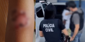 Homem é pr3so suspeito de t0rturar e qu3imar os próprios filhos com metal aquecido em Manaus