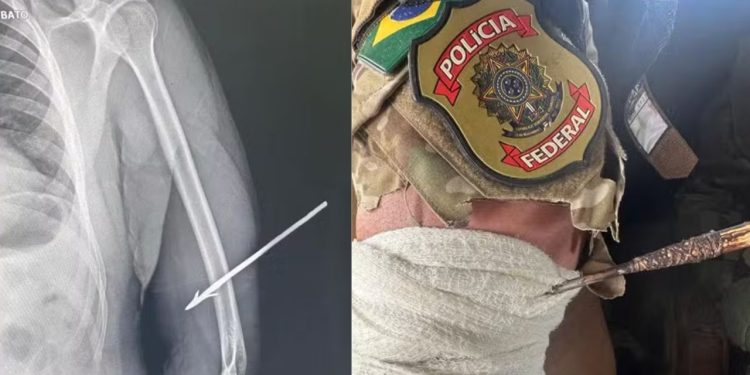 Agente da Polícia Federal é atingido por flecha durante operação