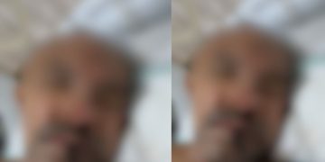 Homem agr3did0 é internado sem documentos e Hospital João Lúcio pede apoio da população