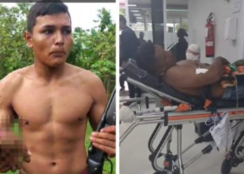 Filho que defendeu o pai com a mão t0rado é elogiado no AM: ‘jovem corajoso’