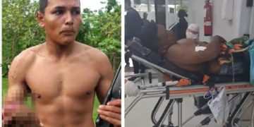 Filho que defendeu o pai com a mão t0rado é elogiado no AM: ‘jovem corajoso’