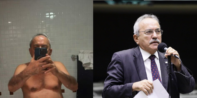 Aos 79 anos, ex-deputado federal posta por engano foto ínt1ma em rede social mostrando tudo; veja