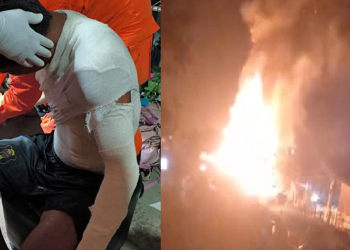 Por causa da botija de gás, homem fica com 30% do c0rp0 queimado em Manaus