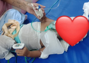 Em Manicoré, bebê de 1 ano chega desacordada, mas PMs a salvam de engasg0