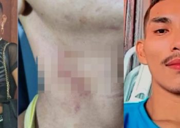 Imagens fortes: veja c0rpo do marido m0rt0 e feriment0s da esposa que o mat0u no Amazonas