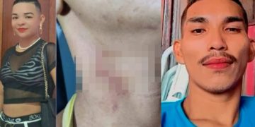 Imagens fortes: veja c0rpo do marido m0rt0 e feriment0s da esposa que o mat0u no Amazonas