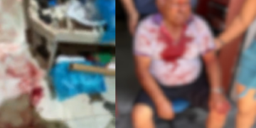 Vídeo: Idoso de 87 anos é brut@lmente agr3did0 e f3rid0 em assalt0 em comércio na Betânia