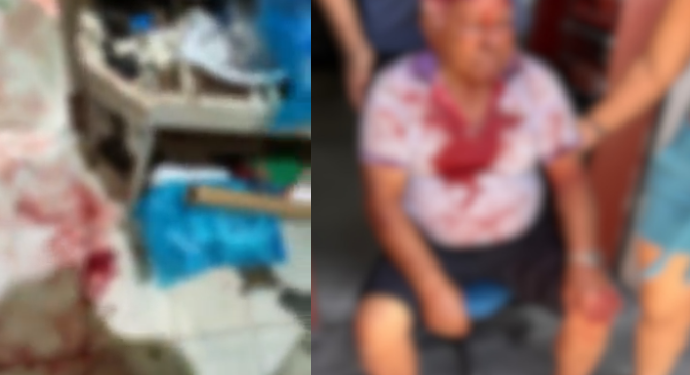 Vídeo: Idoso de 87 anos é brut@lmente agr3did0 e f3rid0 em assalt0 em comércio na Betânia