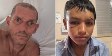 Pacientes sem família no João Lúcio precisam de apoio em Manaus