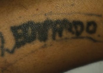 Homem atr0pelado em Manaus está no João Lúcio “esquecido” pela família