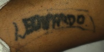 Homem atr0pelado em Manaus está no João Lúcio “esquecido” pela família