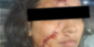 Mulher é atac@da com prato quebrado pelo ex e encontra dificuldades para registrar ocorrência em Manaus